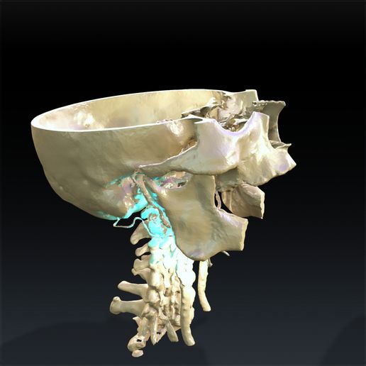 2.jpg SKULL THROAT ANATOMY Human Skeleton BONES NECK DK