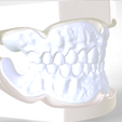 6.png Digital Try-in Full Dentures for Injection Molding