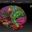 ZB2.jpg MRI Scanned Human Brain model