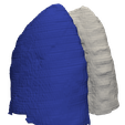 5.png 3D Model of Human Lungs - generated from real patient