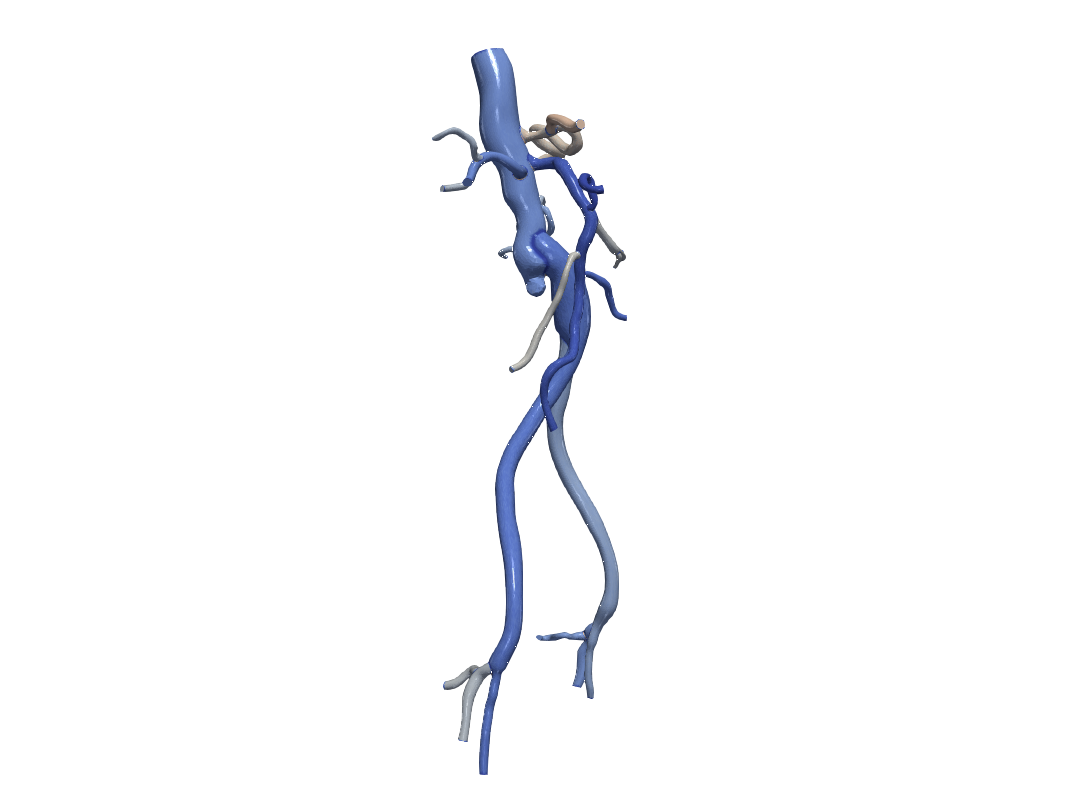 OBJ file 3d model of aorta and femoral arteries・Model to download and ...