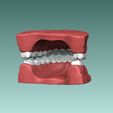 5.jpg Set of Teeth Dental Model