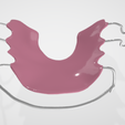 Standard-Hawley-dental-appliance-5.png High resolution Standard Hawley Dental Appliance