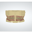 Screenshot_6.png Digital Dental Unsectioned Study Model