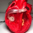 photo_5418047913751331545_y.jpg Cross section human heart anatomy