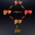 image-1-1.jpg 3D Alchoholic liver disease cirrhosis hepatitis fatty model