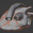 28.png 3D Model of Bicuspid Aortic Valve (BAV)