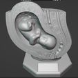 Screenshot_1.jpg Anatomy Model of Pregnancy Pelvis