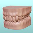 1.jpg Dental Human Teeth model