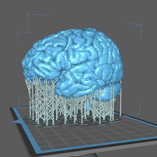 resize-brainchitu.jpg Human Brain