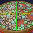 ps18.jpg Diabetes pancreas anatomy microscopy islet beta insulin model