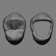 2.jpg maxillary first premolar \\ occlusal restoration model