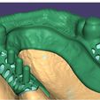 iCXSZl.jpg 3D Dental Laboratory Designs