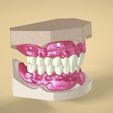 digital-full-dentures-3d-model-stl.png3.jpg STL file Digital Full Dentures・3D printer model to download