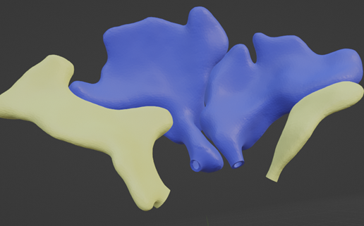 sinus,-nasal,-frontal,-ethmoid,-sphenoid,-orbital,-oral,-dental,-nose,-maxillary,-nerve,-head,-skull.png 通过真实 CT 扫描获得的鼻腔鼻窦高分辨率 3D 解剖图：上颌窦、乙状窦（包括眶上乙状窦）、额窦、鼻腔和三个鼻小柱