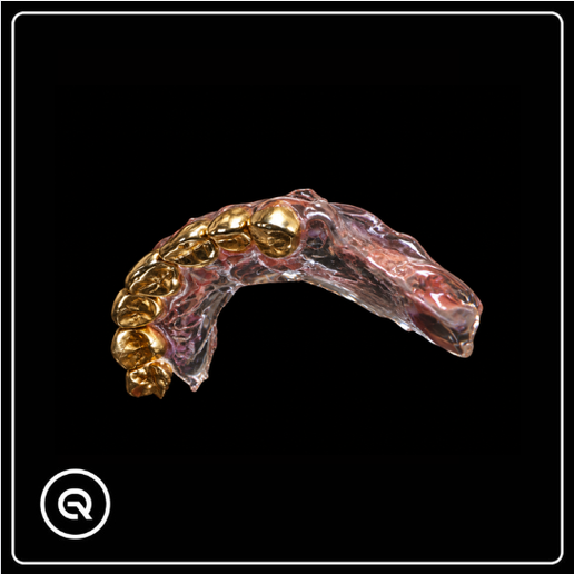 Tooth 24 Dental Crown Design – Student Practice Scan