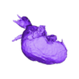 STL00004.stl 3D Model of Human Heart with Patent Ductus Arteriosus (PDA) - generated from real patient