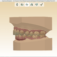 Screenshot_2.png Digital Orthodontic Study Models with Virtual Bases