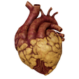 Obese_001.png Anatomical model of obese heart