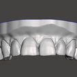 WhatsApp-Image-2024-04-14-at-11.58.29.jpeg Digital dental model for practice
