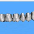 Dentes-Maxila-Alternative-Exocad-03.jpg Teeth Upper Jaw - Exocad - Alternative
