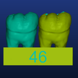 Screenshot_5.png Restorative model of the 46th tooth for dental students