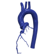4.png 3D Model of Aorta and Coronary Arteries - 6pack