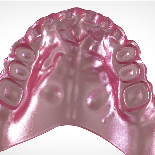 Screenshot_13.png Download OBJ file Digital Full Dentures for Gluedin Teeth with Manual Reduction • 3D printable design, LabMagic3DCAD