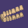 Screenshot-2026-08-23-173448.png DA2600 Library for Exocad