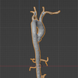 4.png 3D Model of Aorta and Aortic Vessel Tree - generated from real patient