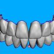 02.jpg Teeth for temporary crowns - maxillary+mandibular-teeth