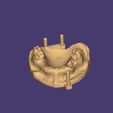 Clipboard-2024-12-21-00-17-12.jpg DIGITAL FLEXIBLE PARTIAL DENTURES upper + lower (3D models !!!) - 12 stl files for download