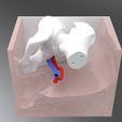 mold3.jpg Anatomical Femoral Artery Cannulation Simulator for Ultrasound Guidance
