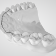 Fix-lingual-retainer-3.png High resolution Fix Lingual Retainer Dental Appliance