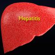 ps9.jpg 3D Alchoholic liver disease cirrhosis hepatitis fatty model