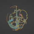 uv21.png 3D Model of Brain Arteriovenous Malformation