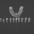 2.png Dental models with removable dies