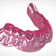 Screenshot_8.png Digital Full Dentures for Gluedin Teeth with Manual Reduction