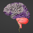 13.png 3D Model of Brain and Aneurysm