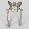 Image1.jpg Hip Replacement model