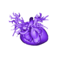 STL.stl 3D Model of Human Heart with Double Outlet Right Ventricle (DORV) - generated from real patient