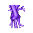 STL- aatrachea.stl 3D Model of Double Aortic Arch