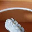 received_2407959332669357.jpeg Training Teeth for Dental Students Black Dental Caries Classification