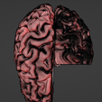 14.png 3D Model of Brain - section