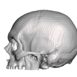 Captura-de-Pantalla-2023-08-22-a-la-s-6.39.43-p. m.png skull fracture / skull fracture