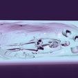 08.jpg Skeleton in Saka excavations