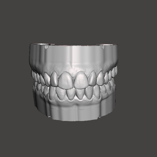 DENTAL STUDY MODELS 3D model