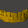 2.png Dental Model
