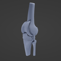 K5.png STL file Knee Replacement・Model to download and 3D print