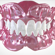 Screenshot_18.png Digital Full Dentures for Gluedin Teeth with Manual Reduction